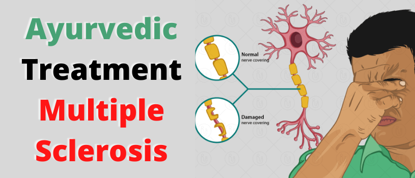 Treatment Of Multiple Sclerosis According To Ayurveda